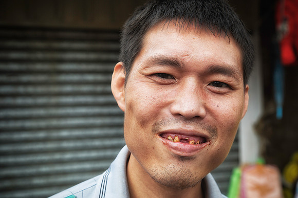 Betel Smile, by Dean Chiang, Xyclopx